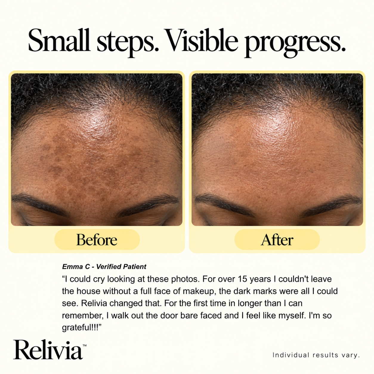 Relivia Glutathione Dark Spot Serum